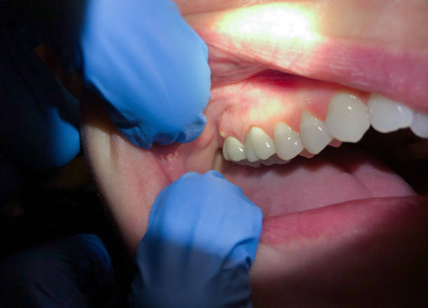 Best Emergency TMJ Treatment in Lemon Grove, CA