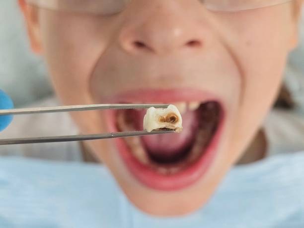 Best Weekend Emergency Dentist in Lemon Grove, CA